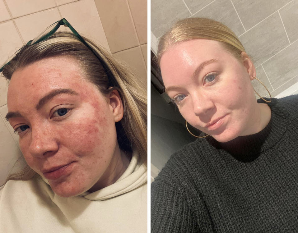 Transform Your Skin, Reclaim Your Comfort