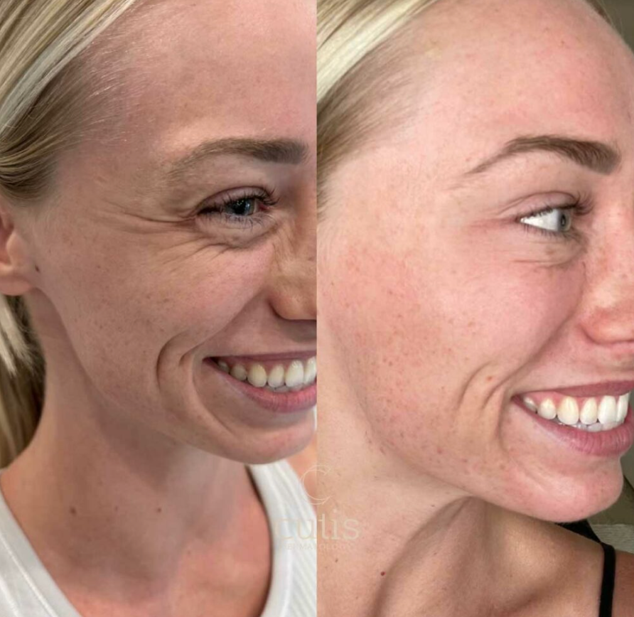 Dermaskins® 30-Days Anti Aging Skincare Set